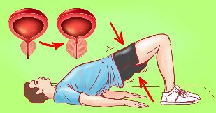 Ushtrimi për prostatit