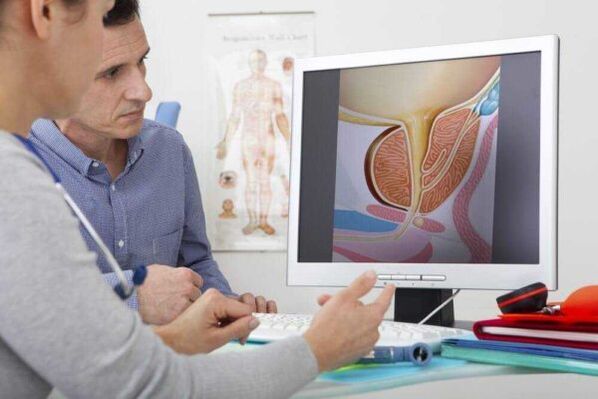mjeku konsultohet me pacientin për çështjen e prostatitit