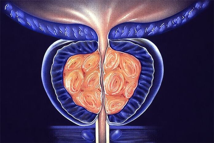 simptomat dhe trajtimi i prostatitit