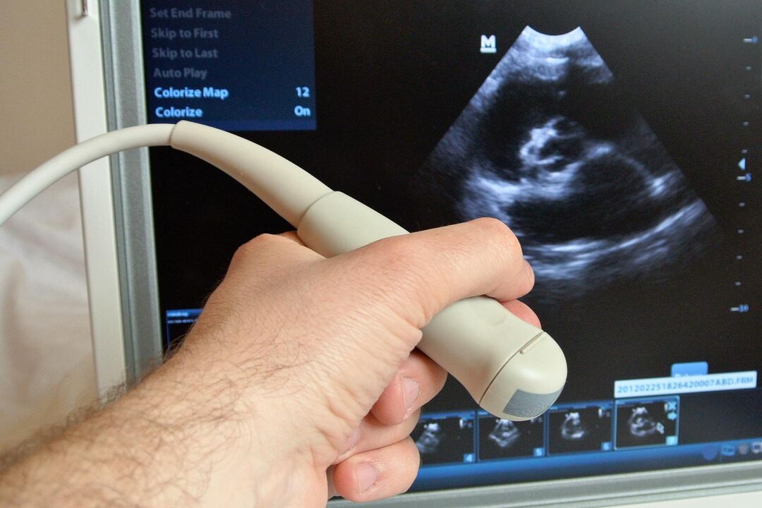 Ultratingulli do të ndihmojë në diagnostikimin e prostatitit kongjestiv tek një mashkull